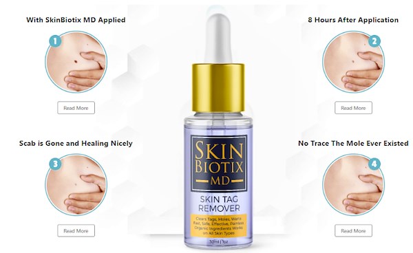 SkinBiotix MD Skin Tag Remover: Ingredients, Facts, Price & Side Effects?