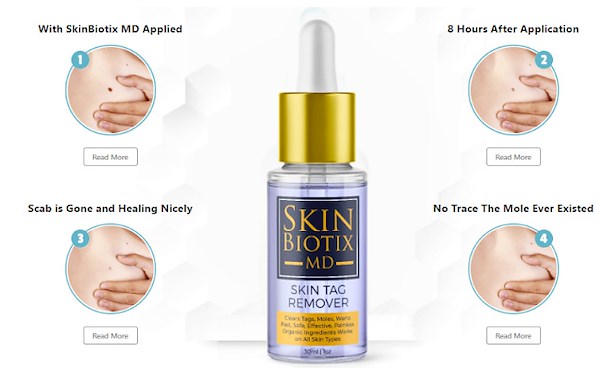 SkinBiotix MD Skin Tag Remover: Price 2023, Benefits, Ingredients, Work & Buy Now?